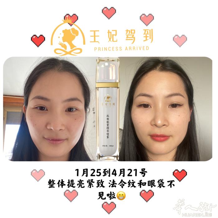 亲身体验三个月的成果 皮肤紧致提升！ 法令纹和眼袋淡化消失[鼓掌][鼓掌]  放