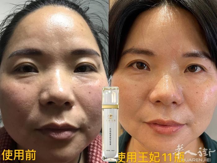 因为一次相信，选择王妃 每天喷一喷，仅仅3个月的时间 轻松实现逆龄5岁‼️‼️‼
