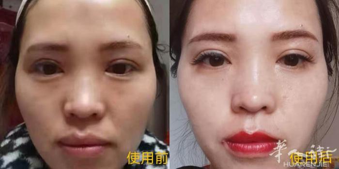 顾客五个月用了三瓶的效果，之前的眼袋没有了，法令纹没了，整个脸都紧致提升了好多，