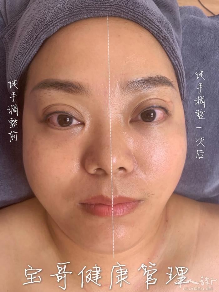 徒手微雕，是目前唯一绿色抗衰老提拉手法，立竿见影。想变美的家人们，请联系我078