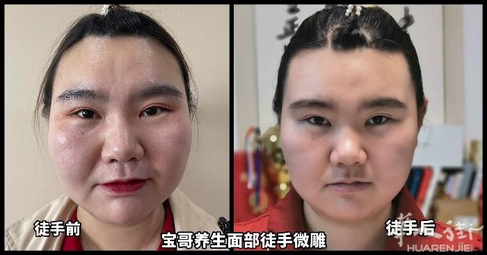 徒手微雕，五次，这样的改变是不是你想要的，十次？二十次呢？不可想象。爱美的姐妹可
