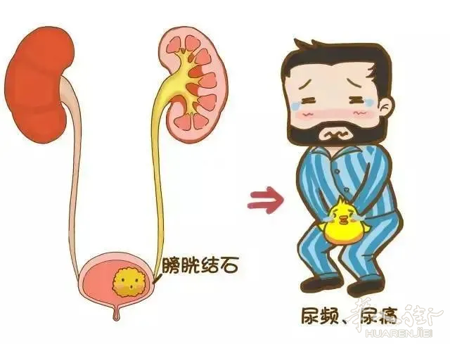 几种最常见的泌尿系统疾病，尽早就诊！  #Padova中意医疗中心#