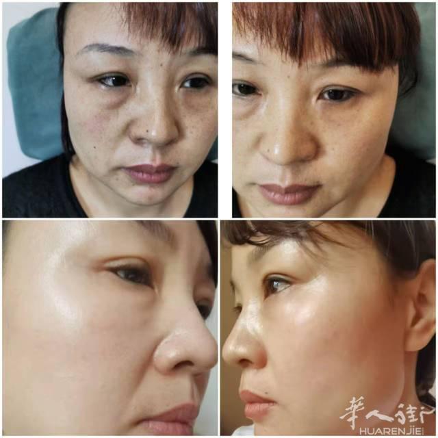 专业去斑，减肥，解决皮肤的所有问题，不打针，不吃药