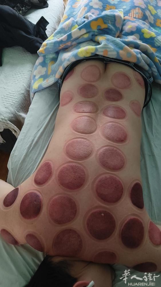 本人女，具有中级按摩师证书，多年的正规中医推拿按摩经验，擅长颈椎、肩周、腰肌劳损