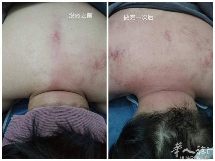 想瘦的，想变美的来。