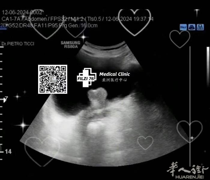 『中国街亚洲医疗中心🏥』可约做B超✔️ B超是唯一对身体没有伤害的放射科检查，