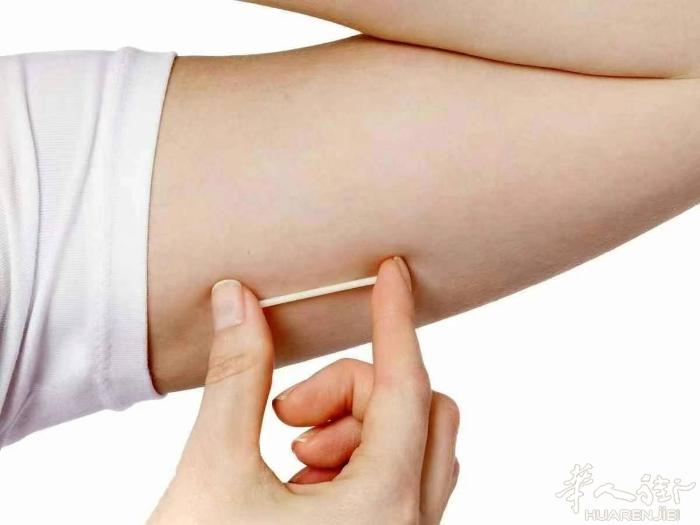 『仁爱医疗中心』皮埋避孕🚺 Nexplanon 是一种皮下埋植式避孕方法，是一