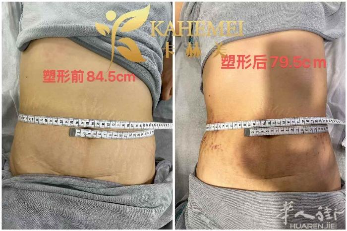 ​想创业？怕投入大？ ​​小成本开启赚钱之路！ ​​健康+美丽，一次搞定！ ​学
