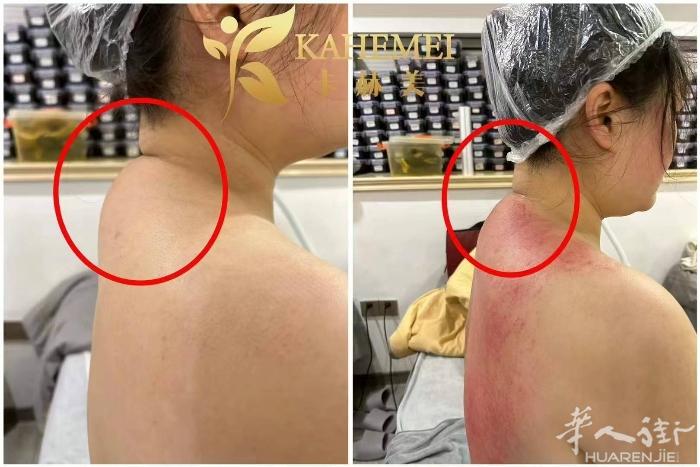 一次就见效，一次见效，一次见效 找我找我 肩颈不适？手臂麻木？腰痛难忍？一次见效