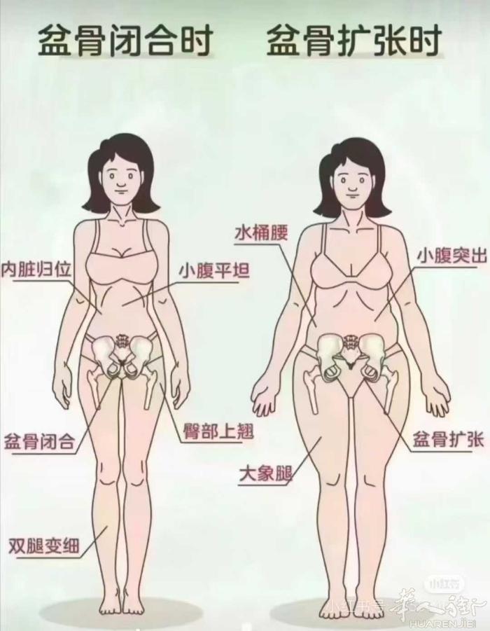 🍁骨盆修复多重要 骨盆矫正不仅会看着变高 关键是可以收胯 改善长短腿 改善腰酸