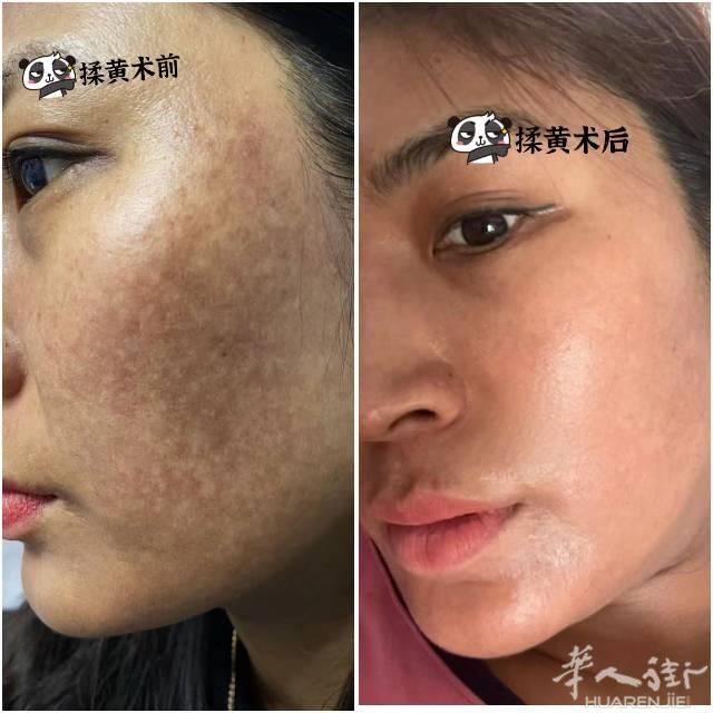 拥有一个干净的脸走出去更自信，地址中国街时代广场，