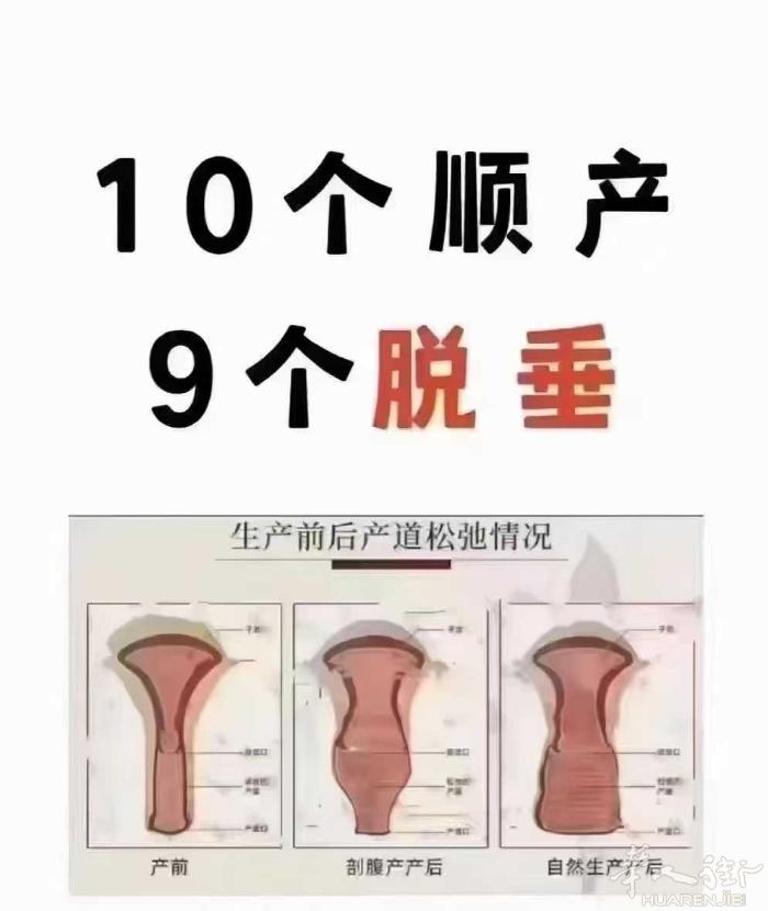 💎无论顺产，剖腹产，女人一样都会松 生完孩子都要做修复，越早越好 为了健康，家