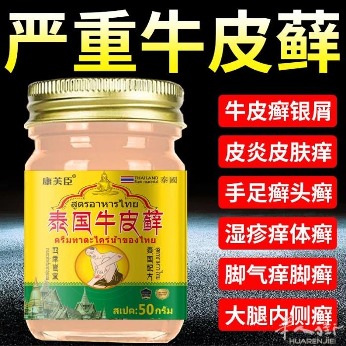 泰国牛皮癣 需要加微信0749412594或扫二维码