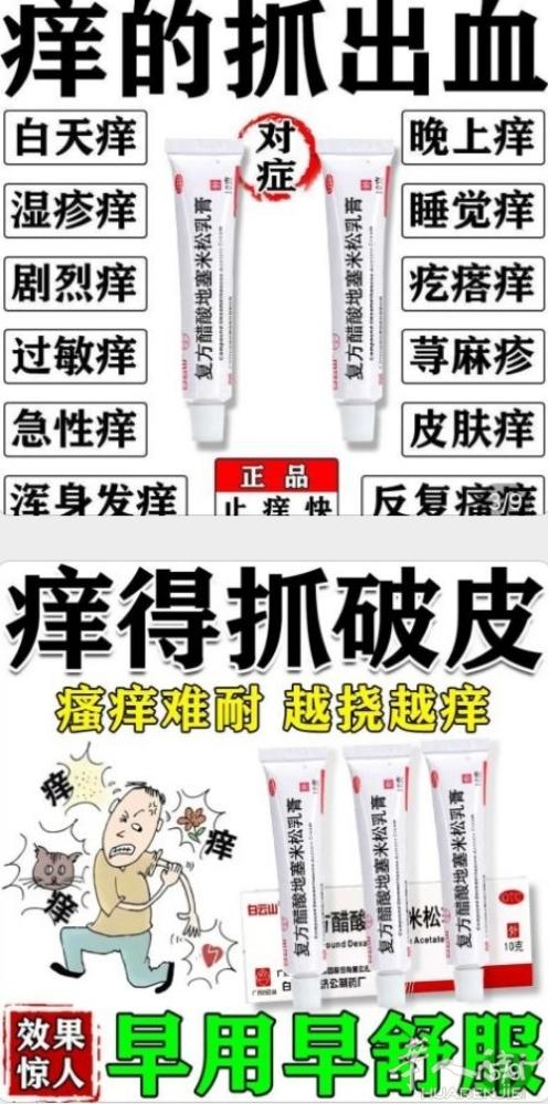止痒药膏有需要的加微信号可以预约优先送货，或电话联系可以送到地铁站