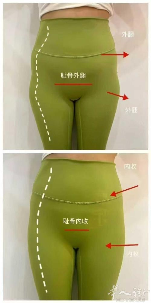 ✅ 产后修复，不是你要做，而是你必须做！ 当产后你的耻骨逐渐张开，盆底肌受损，阴