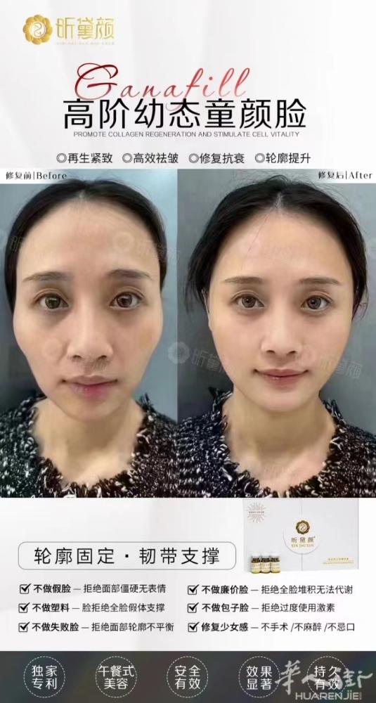昕黛颜高端抗衰：适用全脸打造，相比年轻8-10岁，部位改善，保持时间久，私M水
