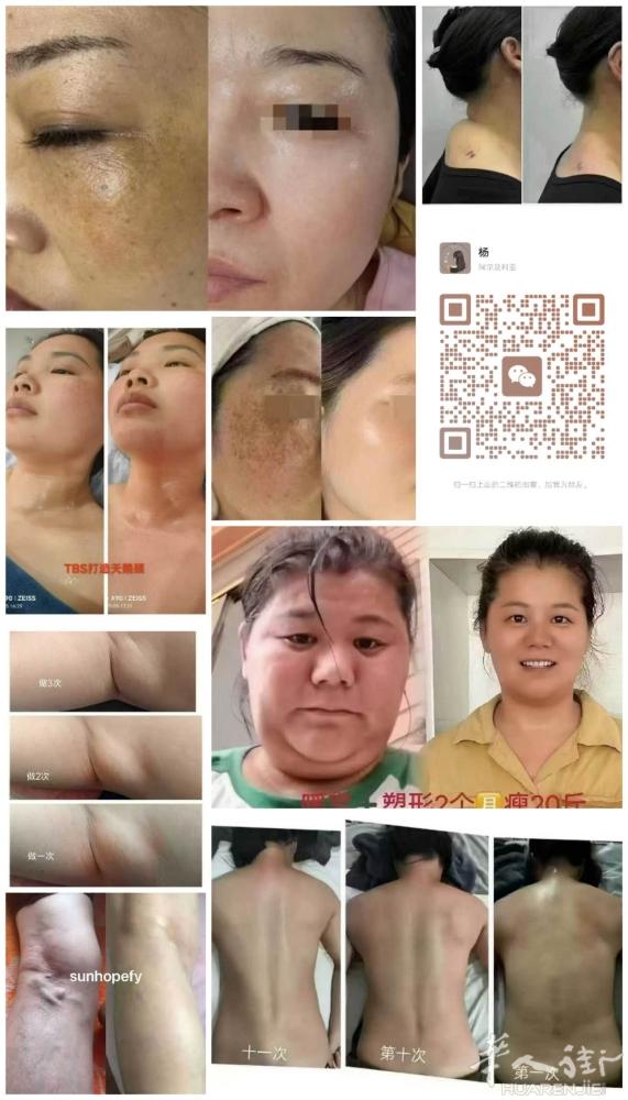 🥼 专业祛斑｜和斑点说再见，遇见透亮自己   「斑点不是天生的标签，而是可以擦