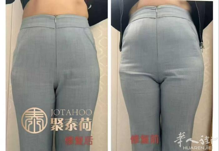 ❤盆腔闭合了更显瘦 内脏复位 臀部形态恢复正常💃🏻 血液循环和新陈代谢也逐渐