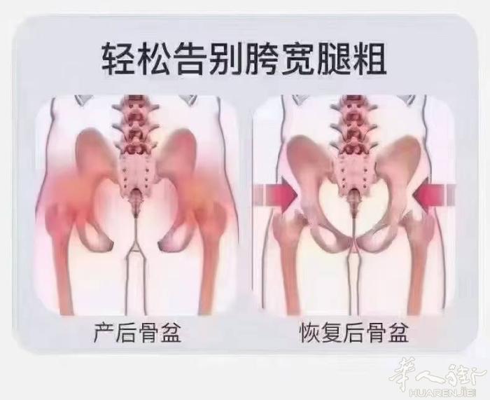 💕纯徒手 无产品 无仪器 无恢复期 随做随走，效果立竿见影⛳ 一次回到未生宝宝