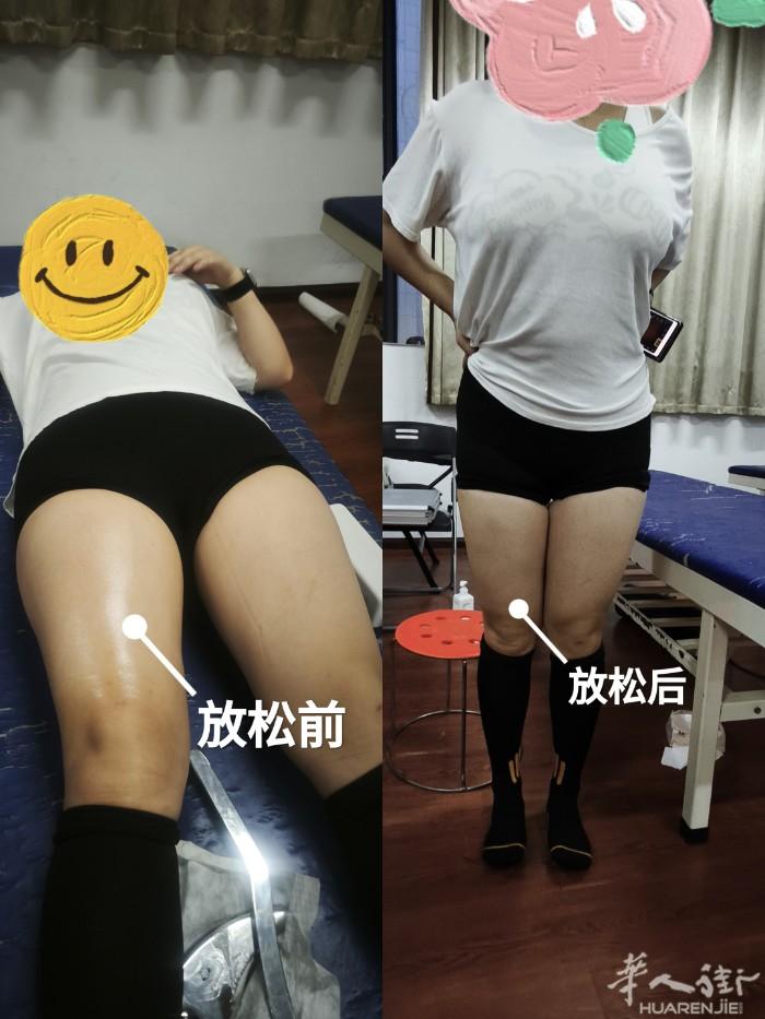 专业筋膜刀师，适用于所有人  主要作用:缓解慢性疼痛