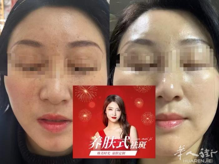专业数10年经验治痘，祛斑，美容护肤