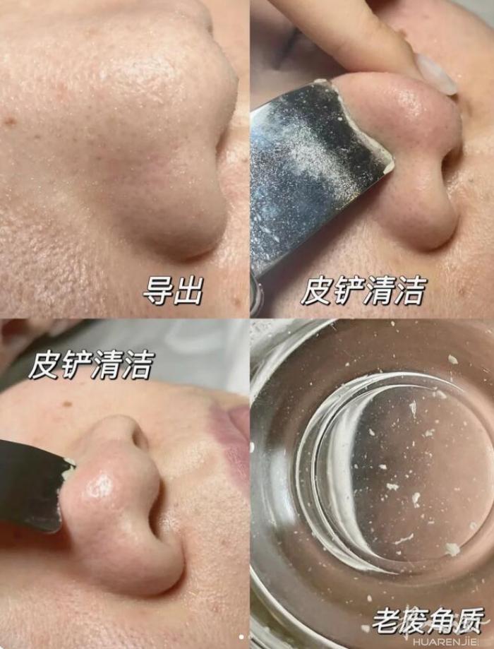脸部深层清洁+补水+嫩肤+头部舒缓按摩＝50€，有工作室也可上门洗脸，上门只接女