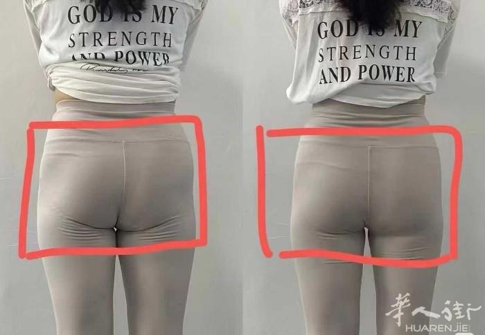 骨盆修复一次前后效果对比 vS 闭合骨盆、恢复身形✔  主要针对产后骨盆疏松、分
