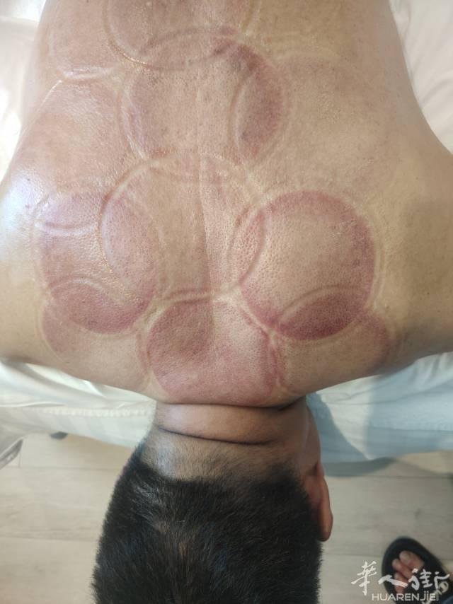 经络养功效，调理疑难杂症，