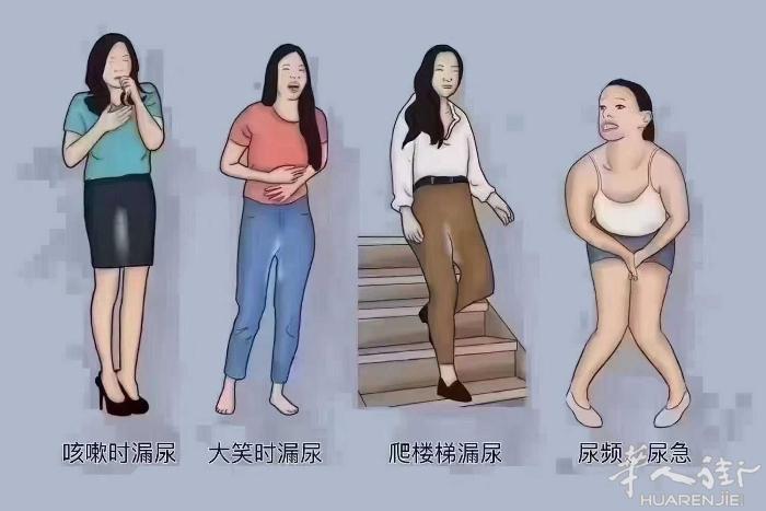 ♥骨盆先评估，再矫正闭合，才是真正有效的修复，每个人的骨盆不一样，修复时用的方法