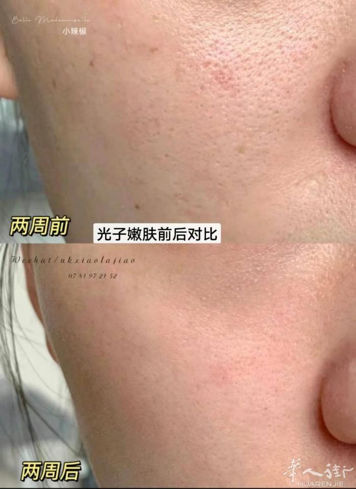 巴黎新式半永久眉眼唇，高端植物色乳 美睫，无痛无痕点痣祛斑祛疣。预约上门