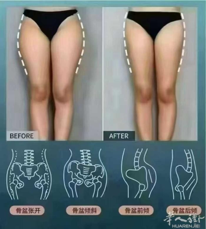 ❤你去做骨修盆复，周围会人有说： 你又不疼不痒的，做什么骨盆？[囧] 可有一天盆