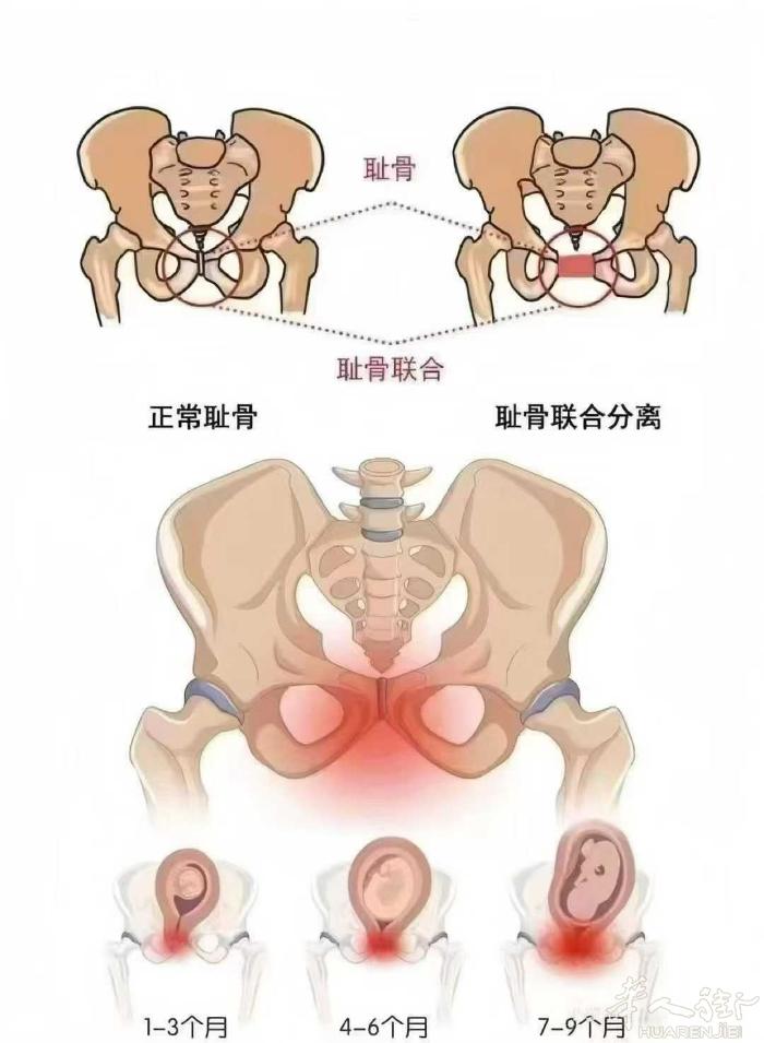 💖#泰式徒手私密 耻骨联合分离只是外观[破涕为笑] 又大又丑又妇女状态吗[苦涩
