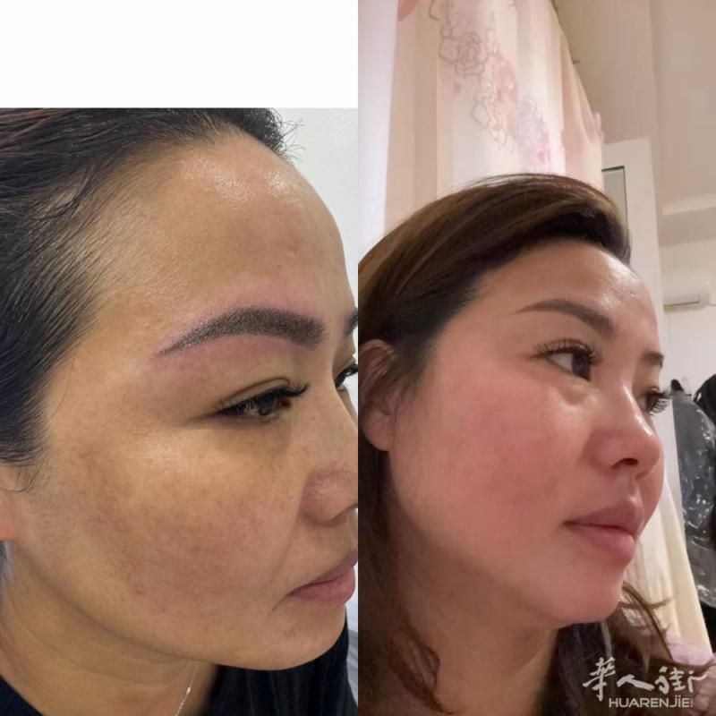 p ra to专业祛斑 终点站 只要你来就有机会 皮肤变得婴儿肌  当你一脸斑