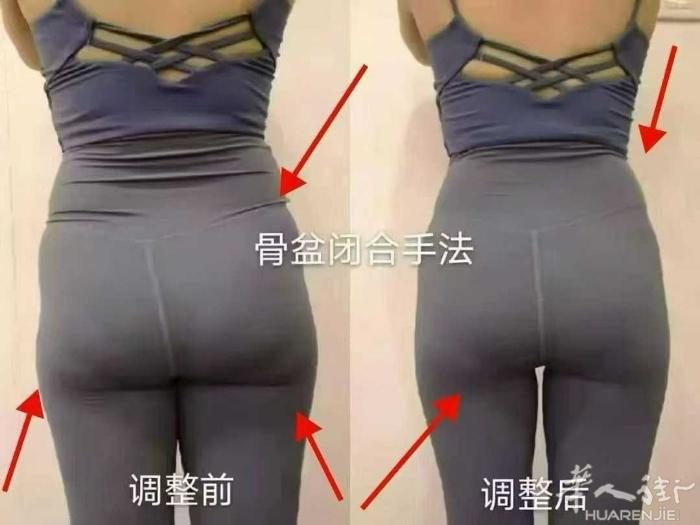 [笑脸]👉 同一个人做完泰式骨盆修复妙变S型，她瘦了吗[恐惧] 一人一症一方案