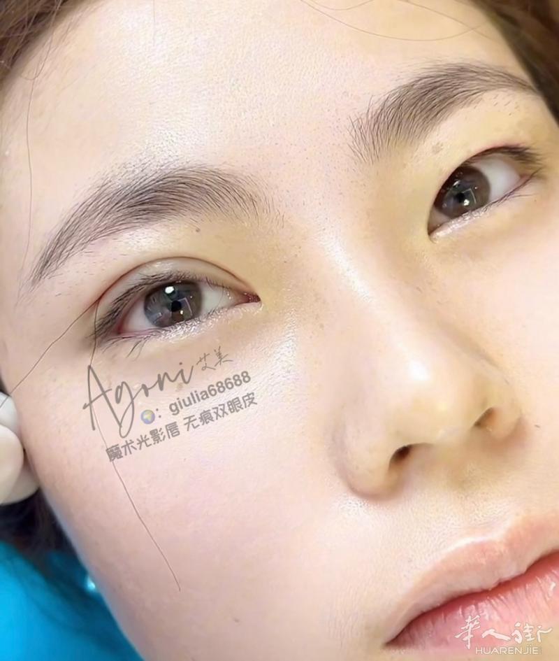 👀 这是不是你们喜欢的 它不‌是传‌统的全切、不‌是传统埋线 它🉑️调‌节、