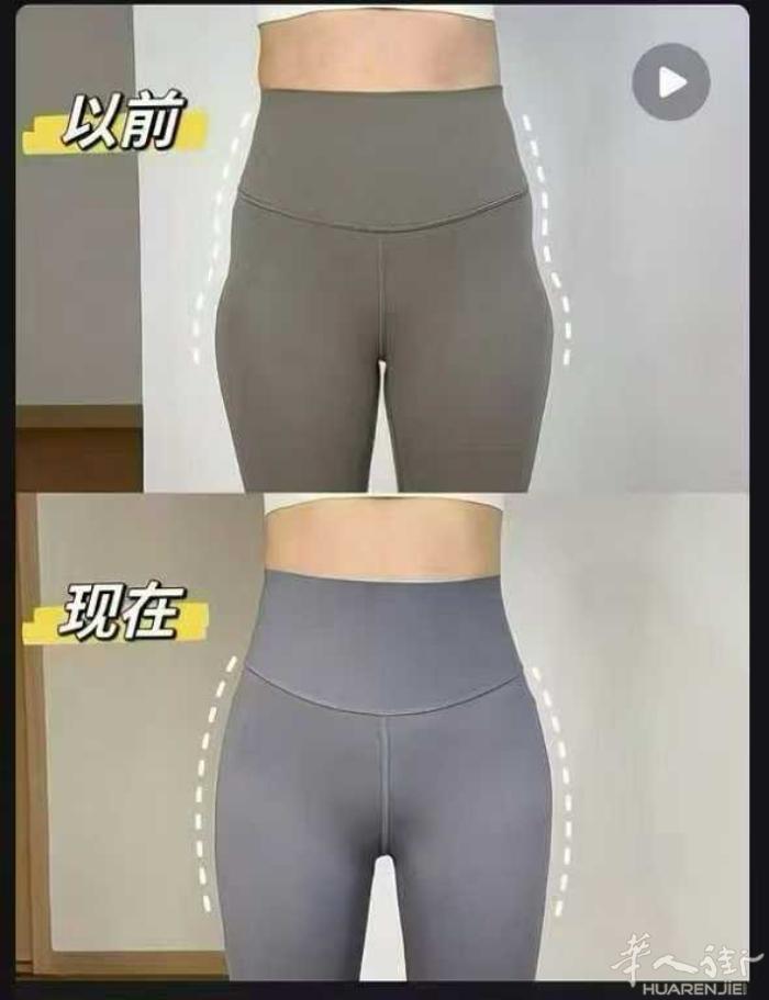为什么“骨盆闭合修复”一定是徒手的❓ 产后的骨盆变形包括： 上移、下移、内旋、外
