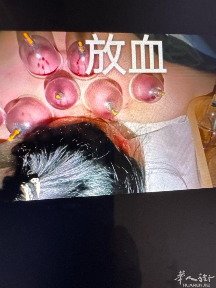 Prato，按摩，洗脚，采耳，艾草泡澡…….需要打电话3454673025电话号