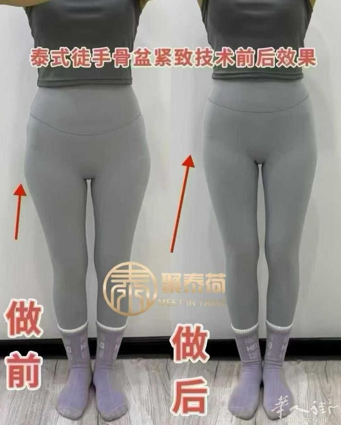 🪷 骨盆修复为什么这么重要⁉⁉ 👀案例👇🏻 第一☝最明显的就是尺寸，瘦身