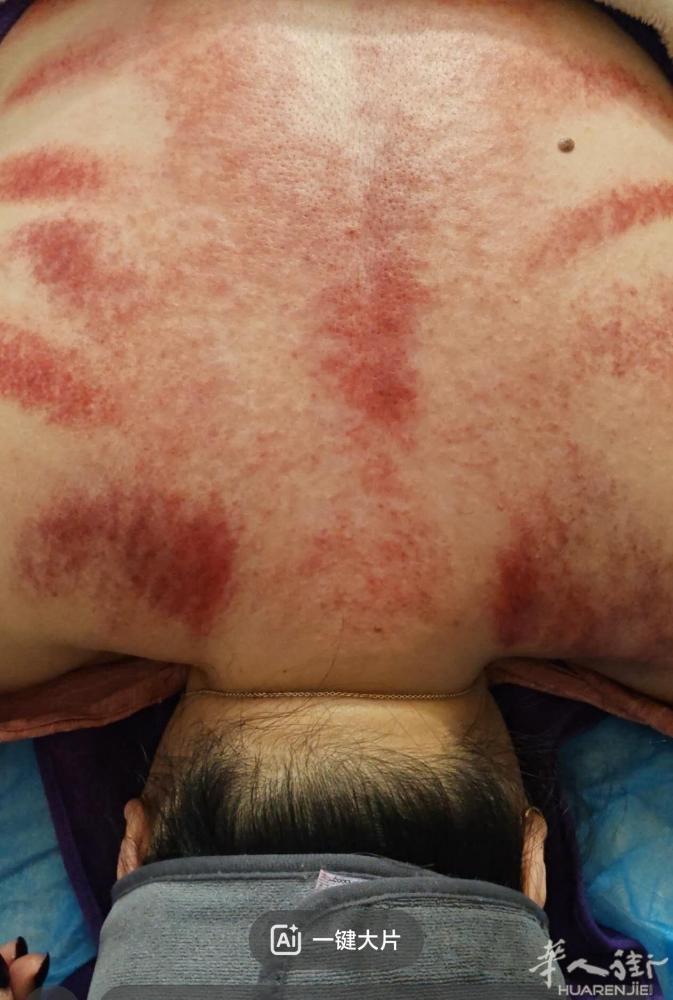 [庆祝][庆祝][庆祝] 好消息，专业推拿理疗师傅来巴黎啦。欢迎来体验。 老师傅