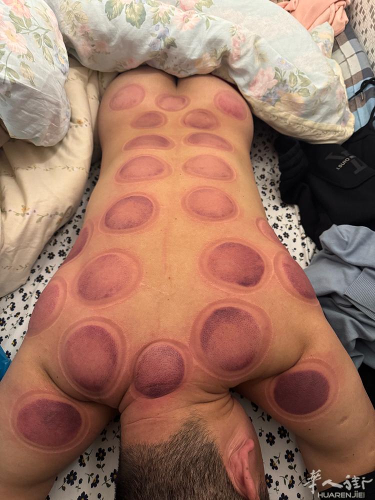 需要推拿，按摩，刮痧，拔罐，足疗，放血火疗，腰疼，腿疼的联系，中药调理按摩联系我