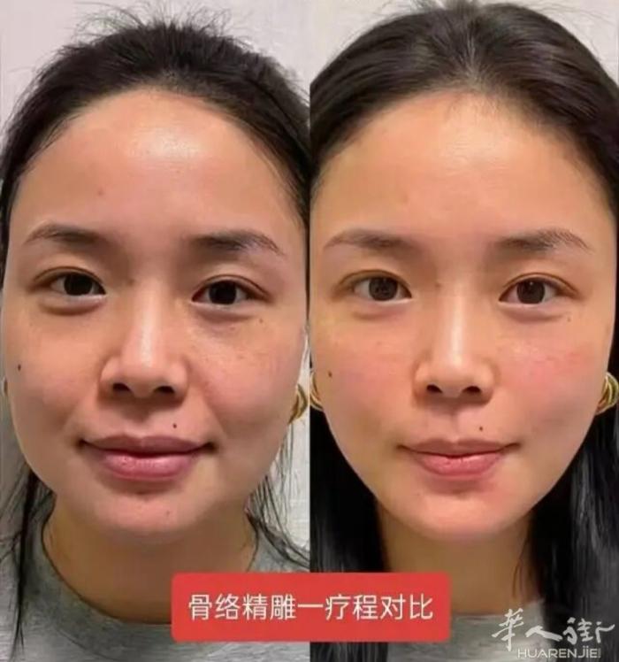 不用动刀打针！中式面部骨雕，徒手捏出年轻紧致轮廓   想改善面部松弛、法令纹、大