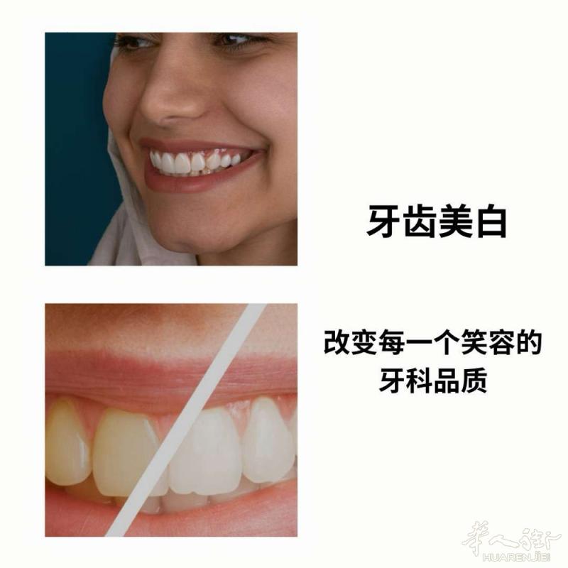 有没有人需要组团去albania修牙齿的，价格比意大利便宜很多很多，速度也很快，