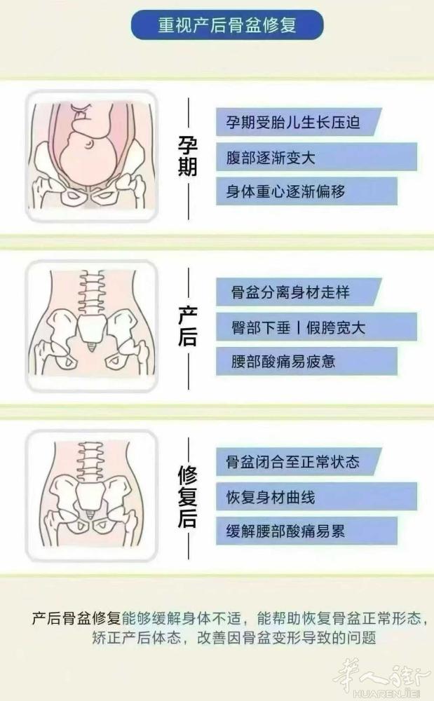 [玫瑰]为什么现在做骨盆闭合的人那么多? 👉因为你花钱不止是修复了一个盆骨，而