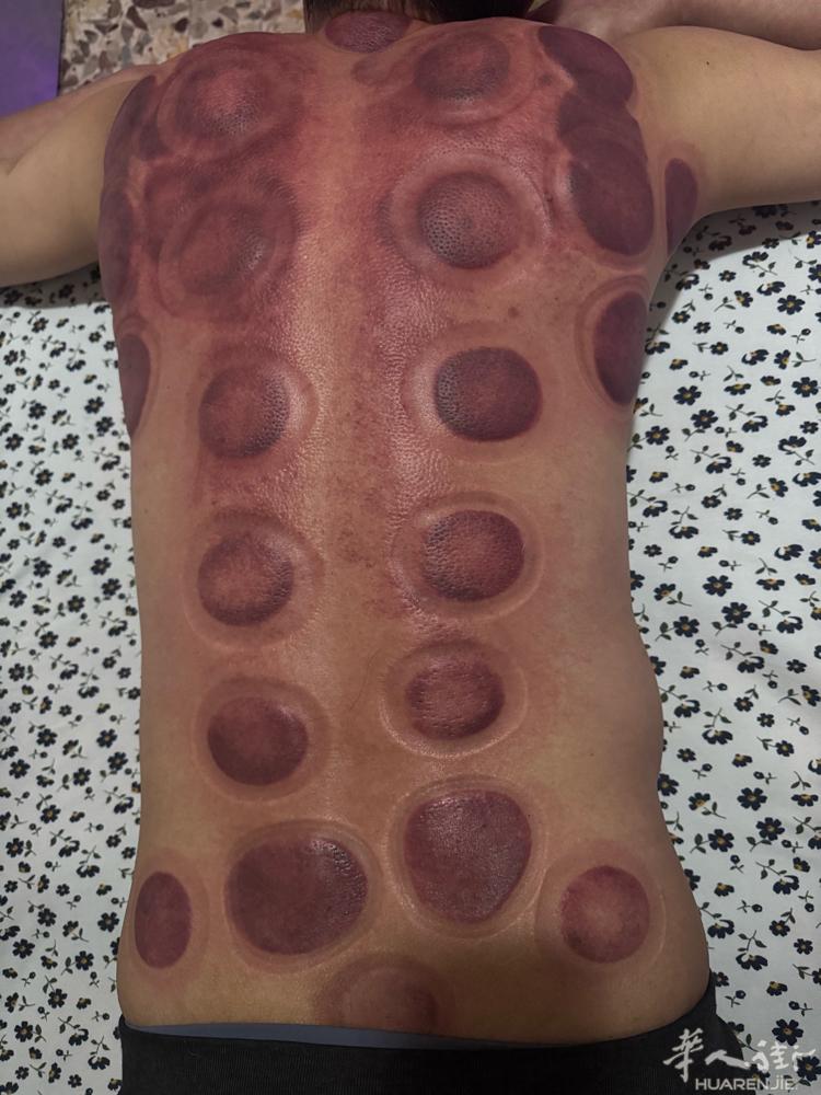 足疗按摩，刮痧拔罐，治疗肩颈腰腿疼，洗耳，采耳，修脚，需要联系