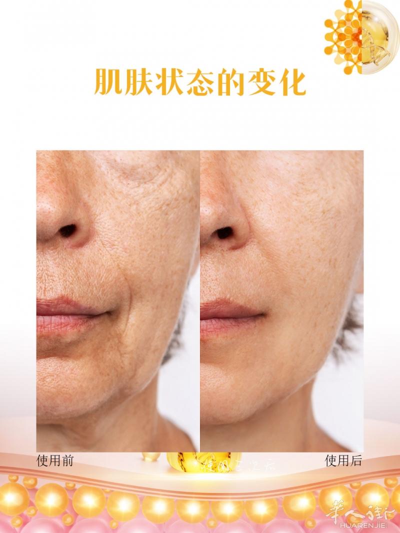 K-beauty 皮肤状态被这支精华拉回来了