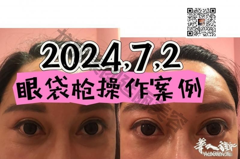 https://att.huarenjie.com/attachment/information/20260220/1771574573581197.jpg