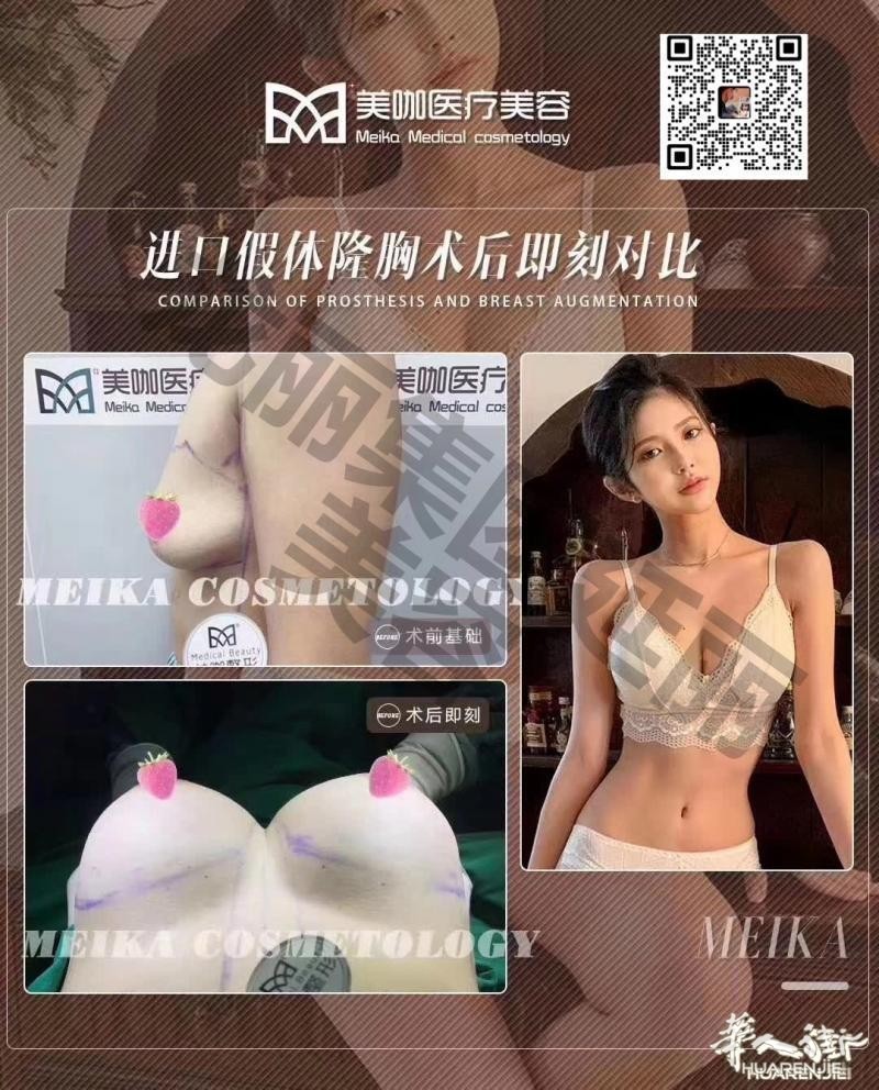 https://att.huarenjie.com/attachment/information/20260220/1771574656402023.jpg