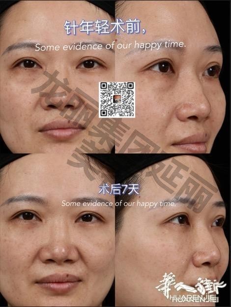 https://att.huarenjie.com/attachment/information/20260220/1771574690595984.jpg