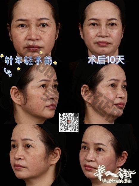 https://att.huarenjie.com/attachment/information/20260220/1771574685680958.jpg