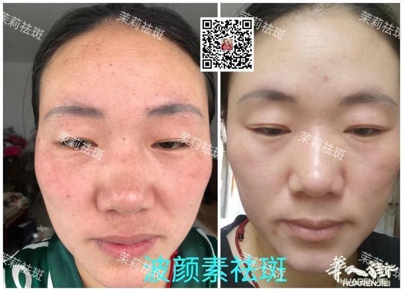 https://att.huarenjie.com/attachment/information/20260220/1771574724837499.jpg